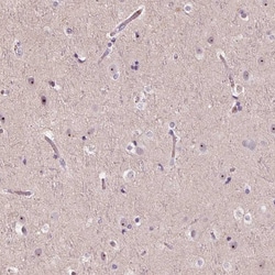 Invitrogen TDIF2 Polyclonal Antibody 100 &mu;L; Unconjugated:Antibodies,