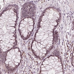 Invitrogen TDIF2 Polyclonal Antibody 100 &mu;L; Unconjugated:Antibodies,