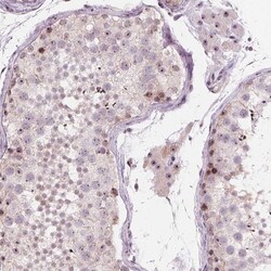 Invitrogen TDIF2 Polyclonal Antibody 100 &mu;L; Unconjugated:Antibodies,