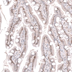 Invitrogen WDSOF1 Polyclonal Antibody 100 &mu;L; Unconjugated:Antibodies,