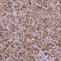 Invitrogen POMGNT1 Polyclonal Antibody 100 &mu;L; Unconjugated:Antibodies,