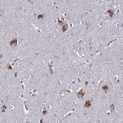 Invitrogen KIAA1324L Polyclonal Antibody 100 &mu;L; Unconjugated:Antibodies,