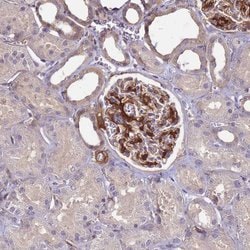 Invitrogen ETNPPL Isoform 1 Polyclonal Antibody 100 &mu;L; Unconjugated:Antibodies,