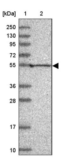 Invitrogen KVbeta1 (KCNAB1) Polyclonal Antibody 100 &mu;L | Buy Online | Invitrogen&trade; | Fisher Scientific