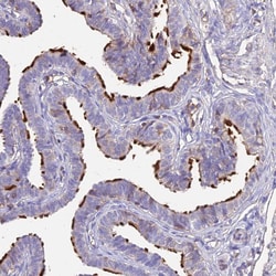 Invitrogen NME5 Polyclonal Antibody 100 &mu;L; Unconjugated:Antibodies,