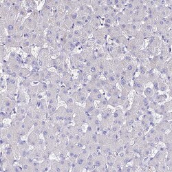 Invitrogen NME5 Polyclonal Antibody 100 &mu;L; Unconjugated:Antibodies,