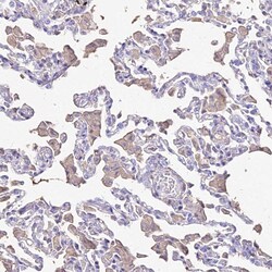 Invitrogen NME5 Polyclonal Antibody 100 &mu;L; Unconjugated:Antibodies,