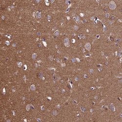 Invitrogen PCDHA5 Polyclonal Antibody 100 &mu;L; Unconjugated:Antibodies,