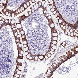 Invitrogen TRAM1L1 Polyclonal Antibody 100 &mu;L; Unconjugated:Antibodies,