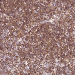 Invitrogen JAKMIP1 Polyclonal Antibody 100 &mu;L; Unconjugated:Antibodies,