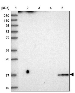 Invitrogen CDNF Polyclonal Antibody 100 &mu;L | Buy Online | Invitrogen&trade; | Fisher Scientific