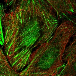 Invitrogen TIGD6 Polyclonal Antibody 100 &mu;L | Buy Online | Invitrogen&trade; | Fisher Scientific