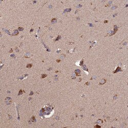 Invitrogen TMEM258 Polyclonal Antibody 100 &mu;L; Unconjugated:Antibodies,