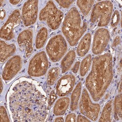 Invitrogen TMEM258 Polyclonal Antibody 100 &mu;L; Unconjugated:Antibodies,