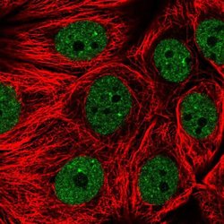 Invitrogen ENOPH1 Polyclonal Antibody 100 &mu;L; Unconjugated:Antibodies,