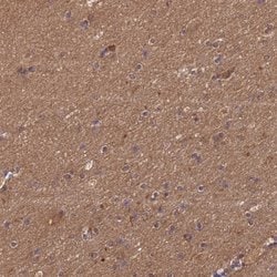 Invitrogen ENOPH1 Polyclonal Antibody 100 &mu;L; Unconjugated:Antibodies,
