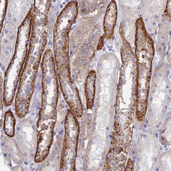 Invitrogen CHSY3 Polyclonal Antibody 100 &mu;L | Buy Online | Invitrogen&trade; | Fisher Scientific
