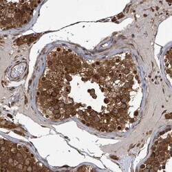 Invitrogen KLC1 Polyclonal Antibody 100 &mu;L; Unconjugated:Antibodies,