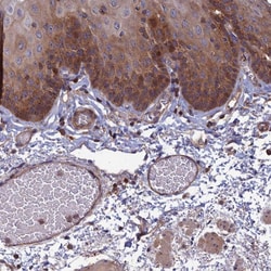 Invitrogen C15orf62 Polyclonal Antibody 100 &mu;L; Unconjugated:Antibodies,