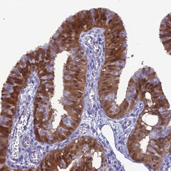 Invitrogen GNPNAT1 Polyclonal Antibody 100 &mu;L; Unconjugated:Antibodies,