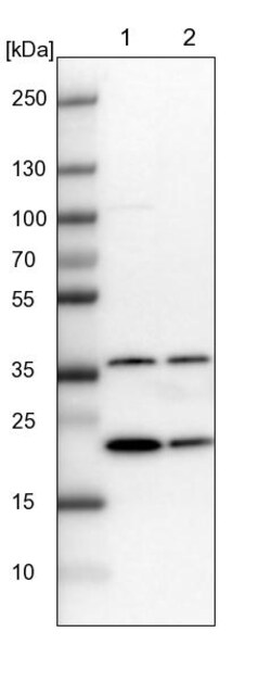 Invitrogen GNPNAT1 Polyclonal Antibody 100 &mu;L | Buy Online | Invitrogen&trade; | Fisher Scientific