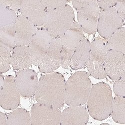 Invitrogen CTTNBP2 Polyclonal Antibody 100 &mu;L; Unconjugated:Antibodies,