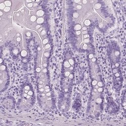 Invitrogen PLIN4 Polyclonal Antibody 100 &mu;L; Unconjugated:Antibodies,