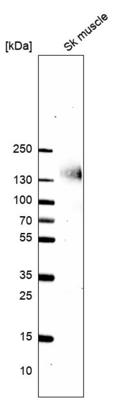 Invitrogen PLIN4 Polyclonal Antibody 100 &mu;L; Unconjugated:Antibodies,