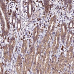 Invitrogen PPP1R26 Polyclonal Antibody 100 &mu;L; Unconjugated:Antibodies,