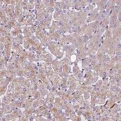 Invitrogen SPDL1 Polyclonal Antibody 100 &mu;L | Buy Online | Invitrogen&trade; | Fisher Scientific