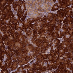 Invitrogen RNaseK Polyclonal Antibody 100 &mu;L; Unconjugated:Antibodies,