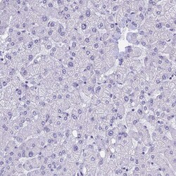 Invitrogen KLF14 Polyclonal Antibody 100 &mu;L; Unconjugated:Antibodies,