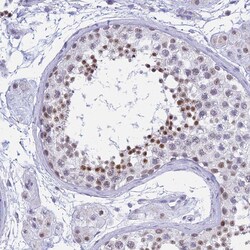 Invitrogen KLF14 Polyclonal Antibody 100 &mu;L; Unconjugated:Antibodies,