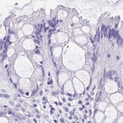 Invitrogen CDSN Polyclonal Antibody 100 &mu;L | Buy Online | Invitrogen&trade; | Fisher Scientific