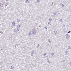 Invitrogen CDSN Polyclonal Antibody 100 &mu;L | Buy Online | Invitrogen&trade; | Fisher Scientific