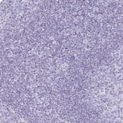 Invitrogen CT45A Polyclonal Antibody 100 &mu;L; Unconjugated:Antibodies,