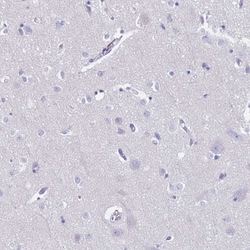 Invitrogen CT45A Polyclonal Antibody 100 &mu;L; Unconjugated:Antibodies,