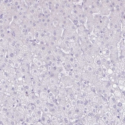 Invitrogen CT45A Polyclonal Antibody 100 &mu;L; Unconjugated:Antibodies,