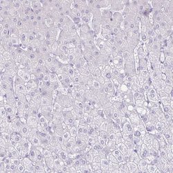 Invitrogen CT45A Polyclonal Antibody 100 &mu;L; Unconjugated:Antibodies,