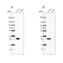 Invitrogen CT45A Polyclonal Antibody 100 &mu;L; Unconjugated:Antibodies,