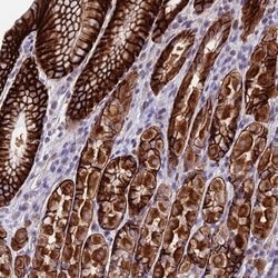 Invitrogen PUS10 Polyclonal Antibody 100 &mu;L; Unconjugated:Antibodies,