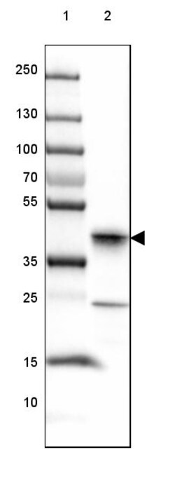 Invitrogen JSRP1 Polyclonal Antibody 100 &mu;L | Buy Online | Invitrogen&trade; | Fisher Scientific