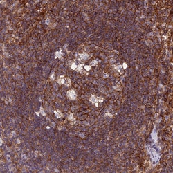 Invitrogen PPP1R18 Polyclonal Antibody 100 &mu;L; Unconjugated:Antibodies,