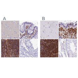 Invitrogen PPP1R18 Polyclonal Antibody 100 &mu;L; Unconjugated:Antibodies,