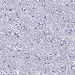 Invitrogen PPP1R18 Polyclonal Antibody 100 &mu;L; Unconjugated:Antibodies,