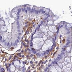 Invitrogen PPP1R18 Polyclonal Antibody 100 &mu;L; Unconjugated:Antibodies,