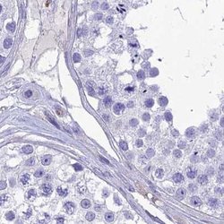 Invitrogen PPP1R18 Polyclonal Antibody 100 &mu;L; Unconjugated:Antibodies,