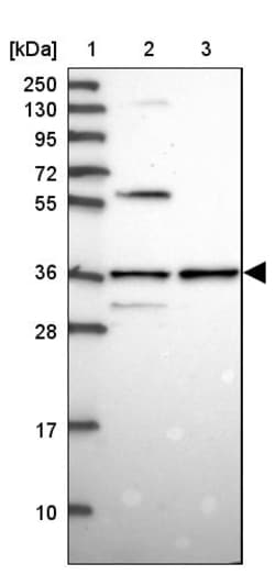 Invitrogen SNX11 Polyclonal Antibody 100 &mu;L; Unconjugated:Antibodies,