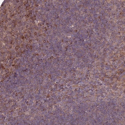 Invitrogen MFSD8 Polyclonal Antibody 100 &mu;L; Unconjugated:Antibodies,
