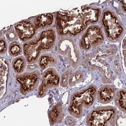 Invitrogen MFSD8 Polyclonal Antibody 100 &mu;L; Unconjugated:Antibodies,